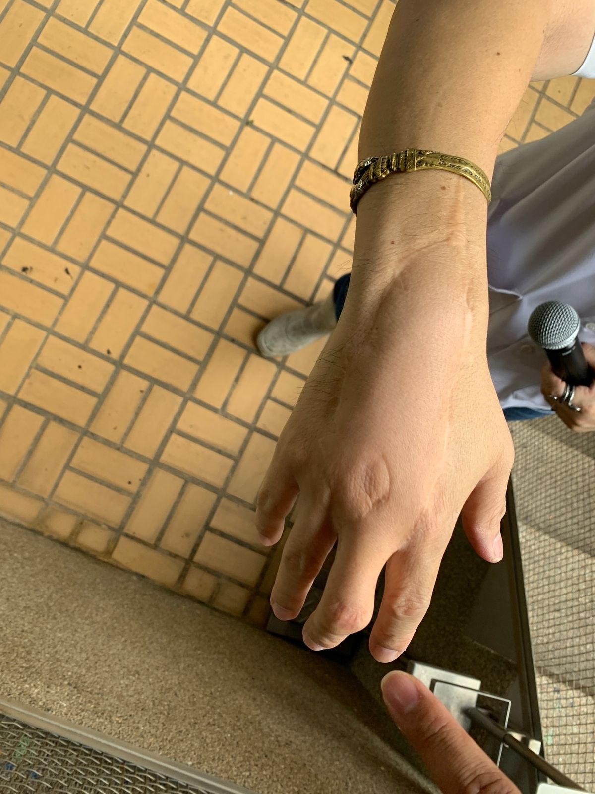 先生のコブラに噛まれた右手だそうです！